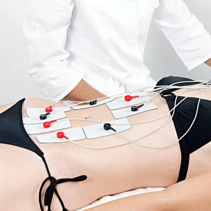 fh-aesthetik-wonderlift-muskelaufbau-bauch-bonn